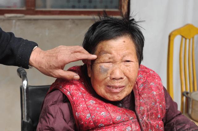 60岁老人一年脑梗多次复发,医生:1种粗粮吃1口等于吃10斤猪油休闲区蓝鸢梦想 - Www.slyday.coM 60岁老人一年脑梗多次复发,医生:1种粗粮吃1口等于吃10斤猪油休闲区蓝鸢梦想 - Www.slyday.coM