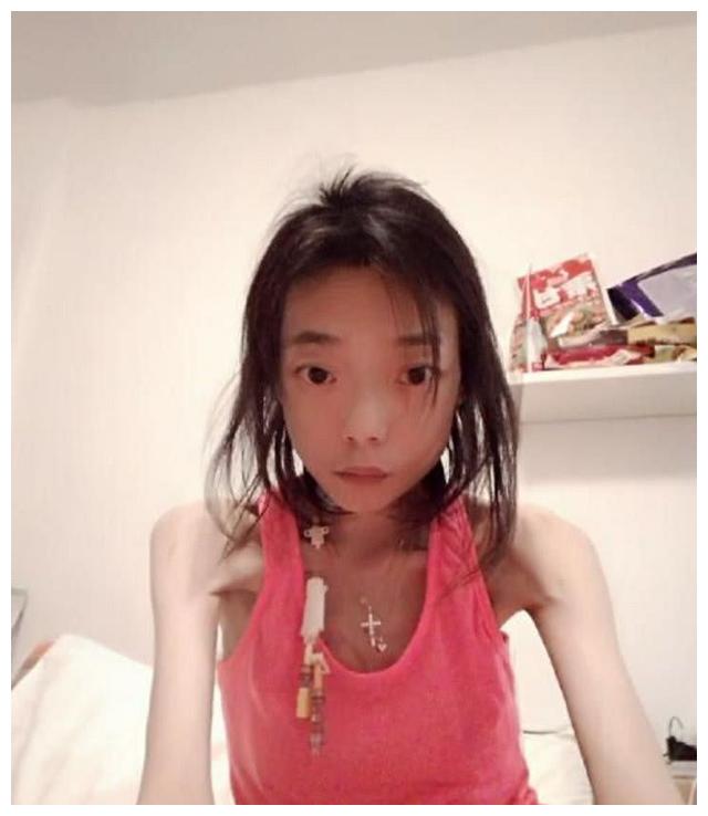 从甜美模特到瘦成骷髅瘫痪嫁入豪门的八年伍智恒经历了什么