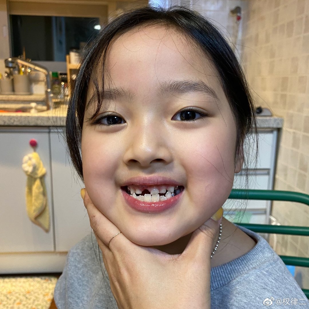 表情包权律二脱牙了 大门呀掉咯