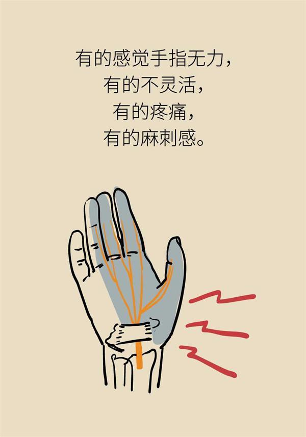 手麻不一定是颈椎病当心是鼠标手惹的祸