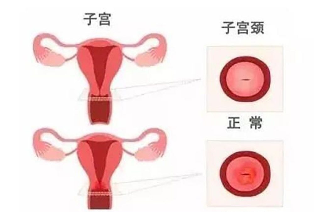 医生|女性|子宫内膜_新浪新闻