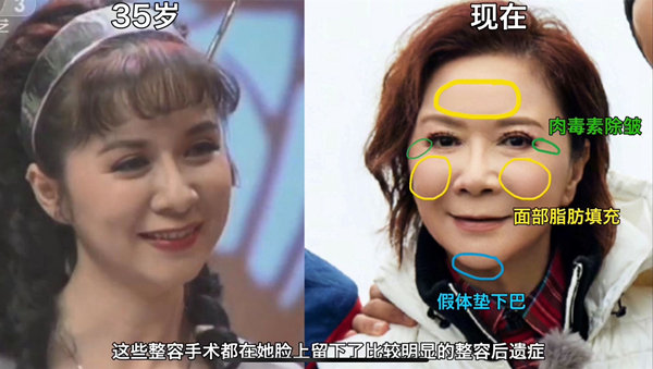 同样是60+，对比8位老牌女星，整容老去和自然老去的差别就出来了