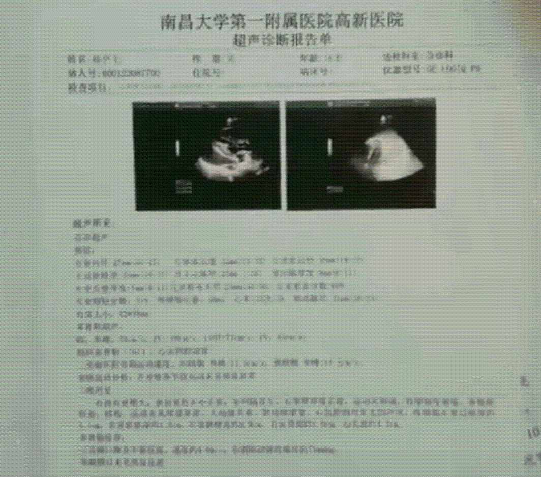 17岁学生工厂实习请假三次遭拒后死亡，家属称每天工作12小时，校方：他是自愿去的休闲区蓝鸢梦想 - Www.slyday.coM