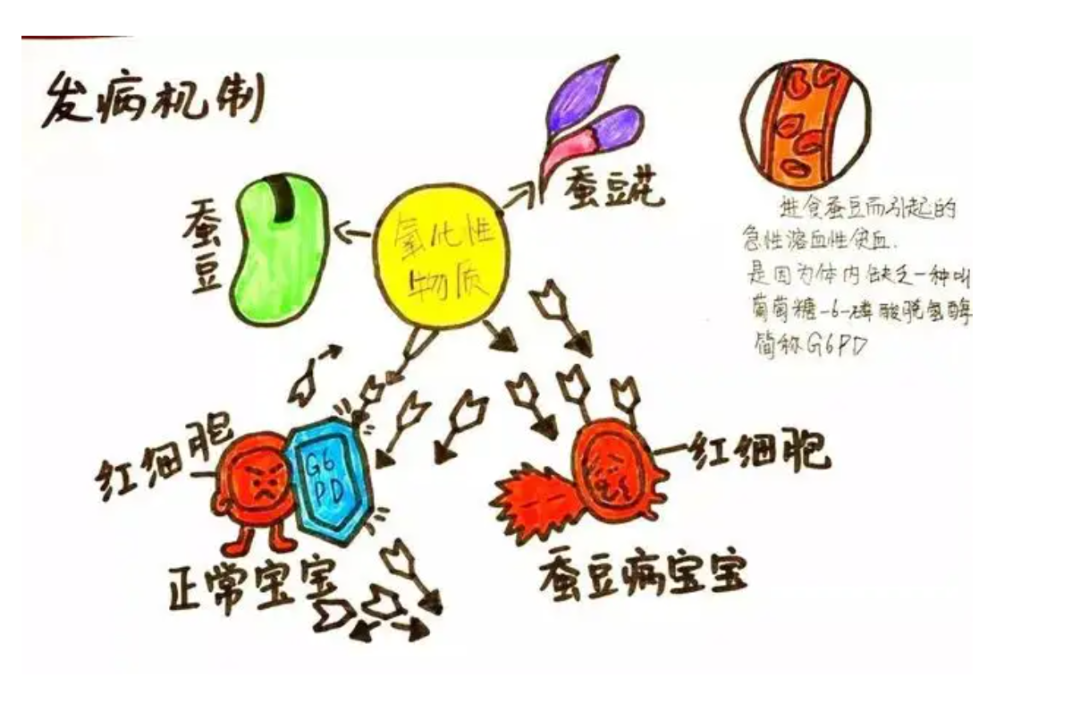 1,蚕豆病也就是一种常见的遗传疾病,发作时很可能会引起患者出现急性