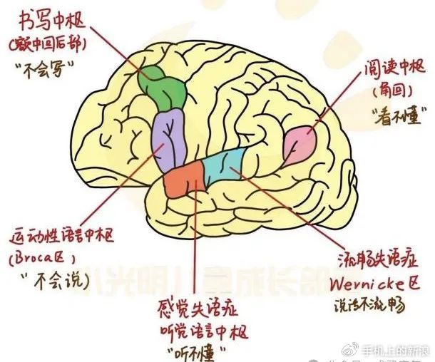康复科普|“爱你在心口难开”?带你了解“失语症”|临床表现|口语|发音|训练|笔画_新浪新闻