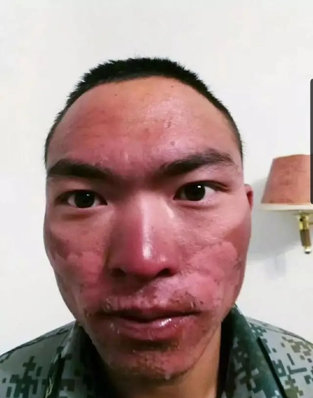 这些满脸沧桑,被晒掉皮的人是我们驻守在青藏高原边防线上的战士