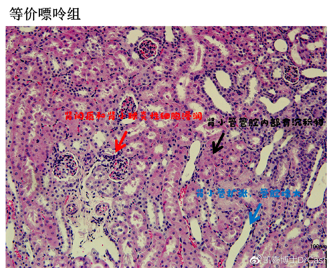 小鼠喝啤酒?闻所未闻!|肾脏_新浪新闻
