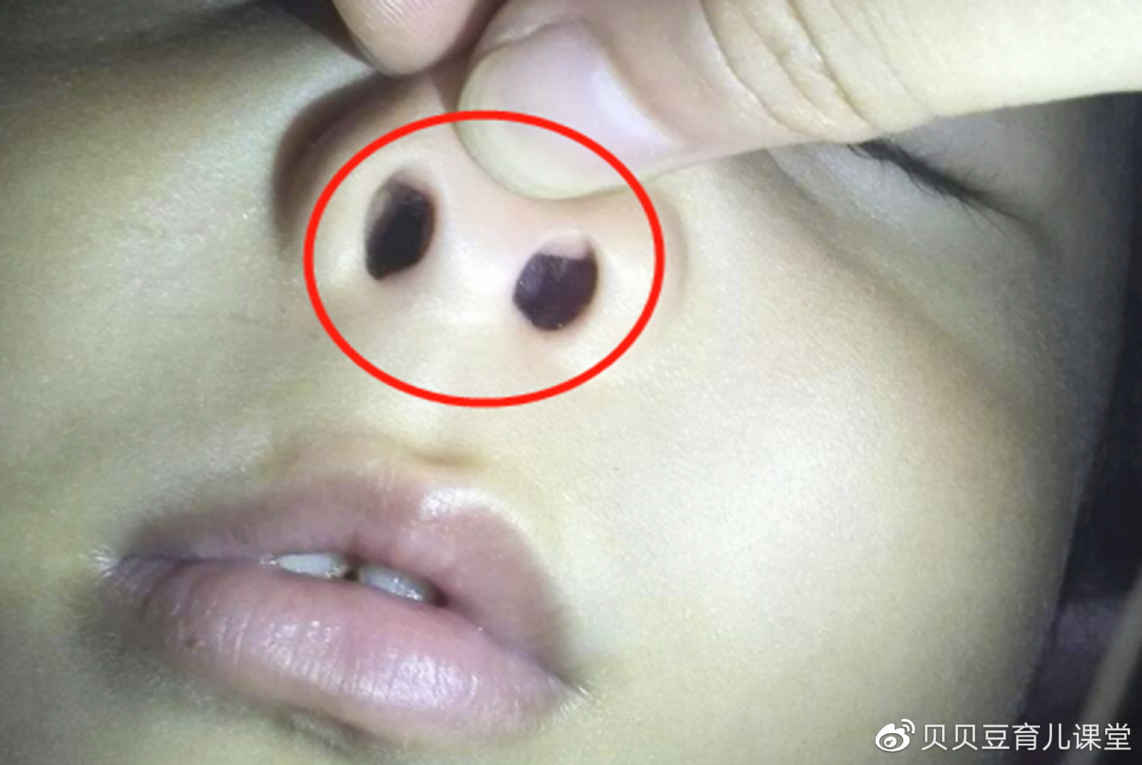 从小爱抠鼻子的孩子长大后怎么样了医生有两种危害等着