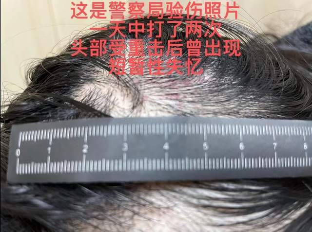 曝演员王东家暴老婆，床上动手狠掐脖子，女方头部重创后短暂失忆休闲区蓝鸢梦想 - Www.slyday.coM