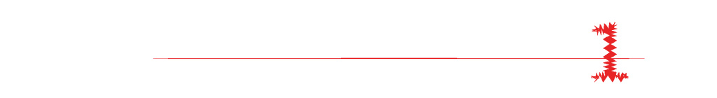 在工厂里断了一根手指后,他为自己买了一双溜冰鞋休闲区蓝鸢梦想 - Www.slyday.coM 在工厂里断了一根手指后,他为自己买了一双溜冰鞋休闲区蓝鸢梦想 - Www.slyday.coM