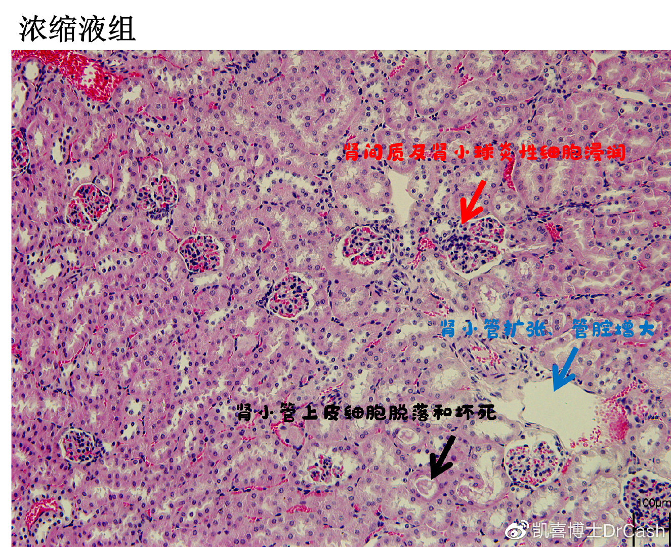 小鼠喝啤酒?闻所未闻!|肾脏_新浪新闻