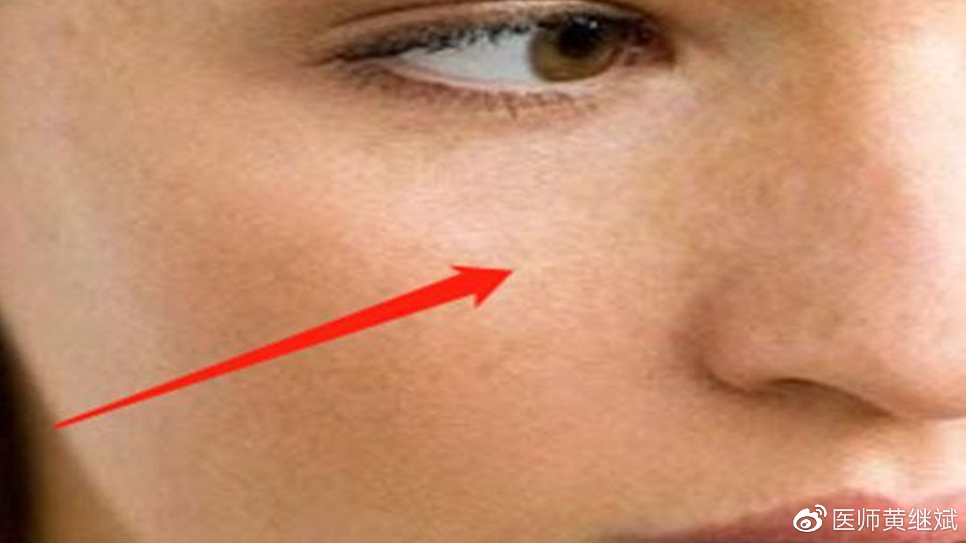 总而言之,我们皮肤发黄不要太过担心,造成的原因多种多样,我们需要用