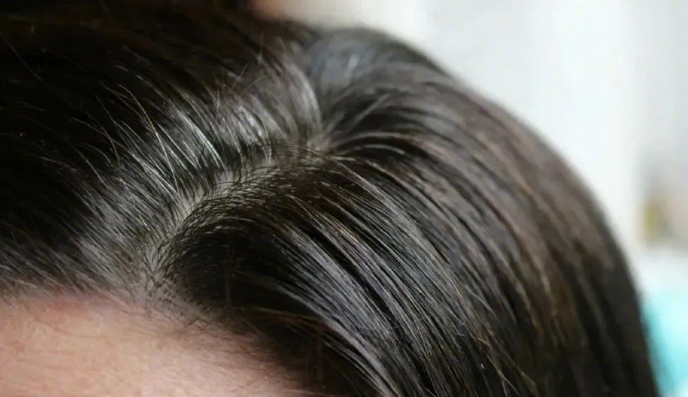 7类人容易提前长白发，不同位置的白头发这样改善休闲区蓝鸢梦想 - Www.slyday.coM