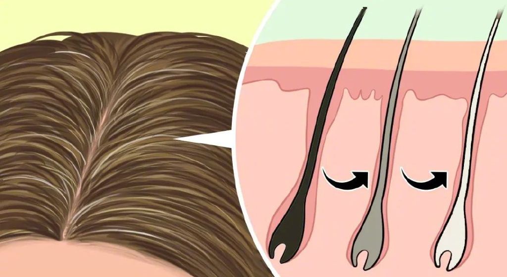 7类人容易提前长白发，不同位置的白头发这样改善休闲区蓝鸢梦想 - Www.slyday.coM