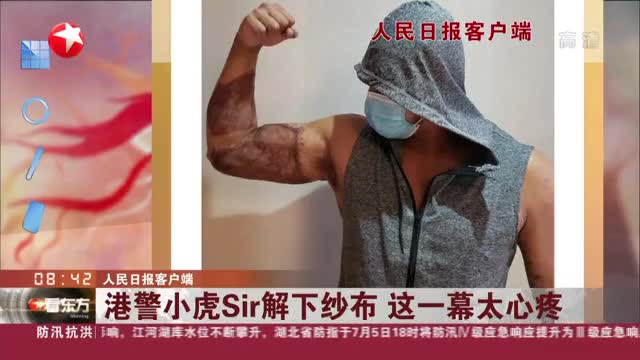 人民日报客户端:港警小虎sir解下纱布 这一幕太心疼