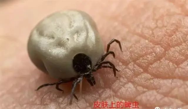 蜱虫为何会使人生病?被叮咬后该如何处理才安全?及时正确取出蜱虫!休闲区蓝鸢梦想 - Www.slyday.coM 蜱虫为何会使人生病?被叮咬后该如何处理才安全?及时正确取出蜱虫!休闲区蓝鸢梦想 - Www.slyday.coM