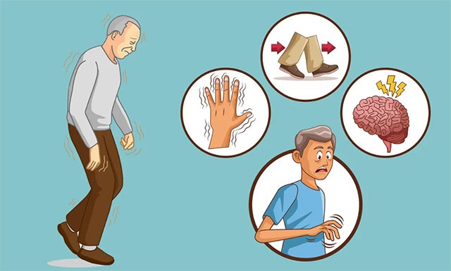 帕金森非运动症状易被忽略医生提醒需加强早期识别