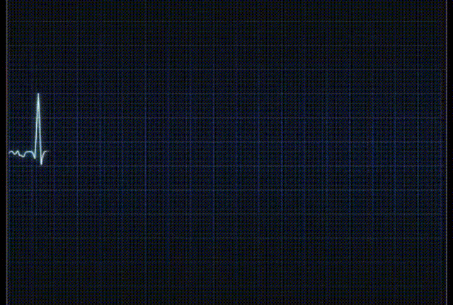 苹果手表「心电图」功能解锁，支持4款机型，快来看你的能不能用休闲区蓝鸢梦想 - Www.slyday.coM