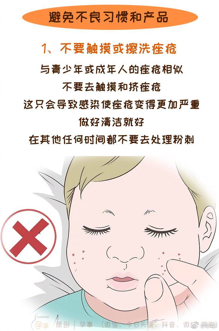 婴儿痤疮最佳治疗方法图片