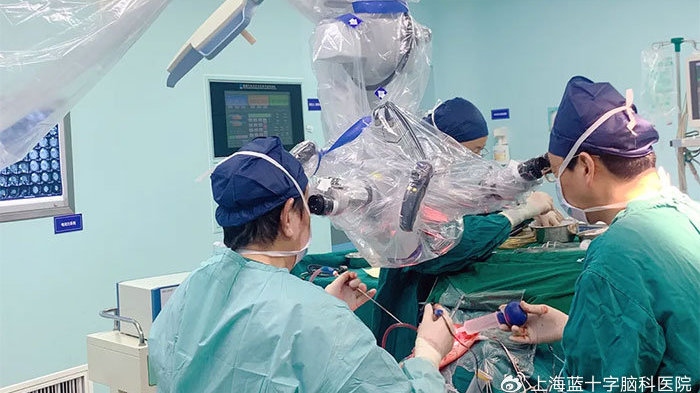 频繁意识丧失竟是颅内藏“鸭蛋” 显微外科手术助六旬女患者顺利康复|脑膜瘤|意识丧失|手术|鸭蛋|患者_新浪新闻