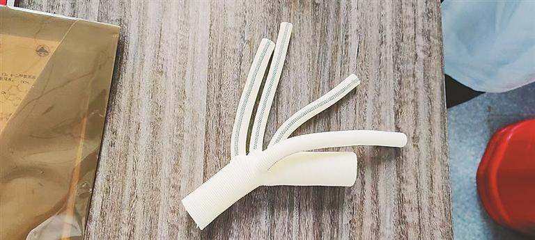 从心脏到大腿 总长近1米血管全换成人工的休闲区蓝鸢梦想 - Www.slyday.coM