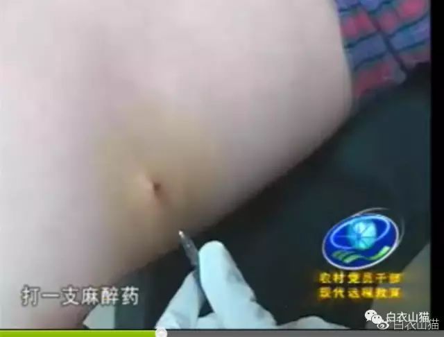 蜱虫为何会使人生病?被叮咬后该如何处理才安全?及时正确取出蜱虫!休闲区蓝鸢梦想 - Www.slyday.coM 蜱虫为何会使人生病?被叮咬后该如何处理才安全?及时正确取出蜱虫!休闲区蓝鸢梦想 - Www.slyday.coM