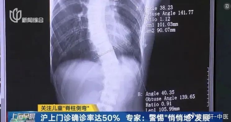 每天揪一揪,背部通畅脸干净,补阳气还不上火|手背|后背|缩影|脏腑|尾椎_新浪新闻