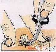 蜱虫为何会使人生病?被叮咬后该如何处理才安全?及时正确取出蜱虫!休闲区蓝鸢梦想 - Www.slyday.coM 蜱虫为何会使人生病?被叮咬后该如何处理才安全?及时正确取出蜱虫!休闲区蓝鸢梦想 - Www.slyday.coM