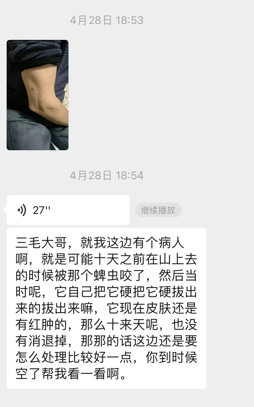 蜱虫为何会使人生病?被叮咬后该如何处理才安全?及时正确取出蜱虫!休闲区蓝鸢梦想 - Www.slyday.coM 蜱虫为何会使人生病?被叮咬后该如何处理才安全?及时正确取出蜱虫!休闲区蓝鸢梦想 - Www.slyday.coM