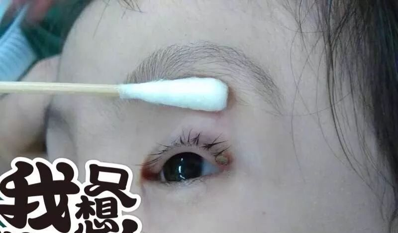 蜱虫为何会使人生病?被叮咬后该如何处理才安全?及时正确取出蜱虫!休闲区蓝鸢梦想 - Www.slyday.coM 蜱虫为何会使人生病?被叮咬后该如何处理才安全?及时正确取出蜱虫!休闲区蓝鸢梦想 - Www.slyday.coM