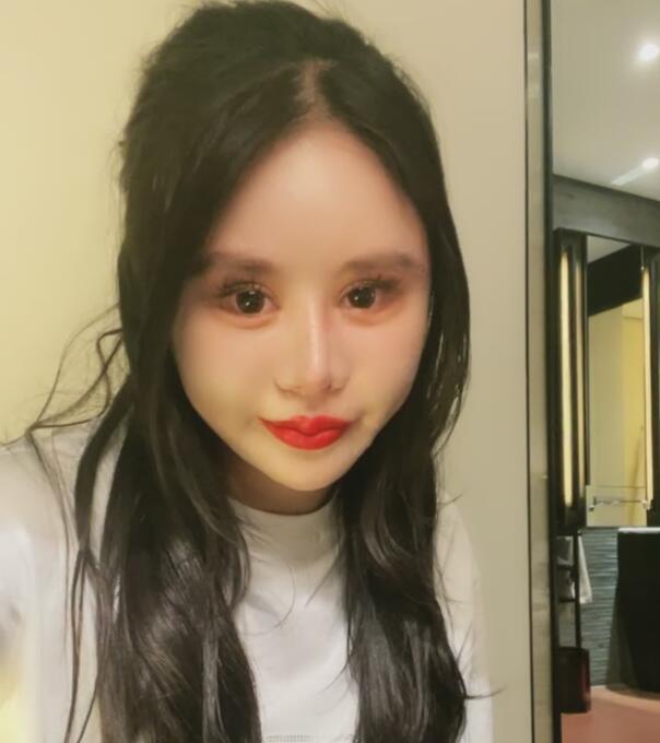 花了500多万却越整越离谱网红小z娜娜的近照不忍直视