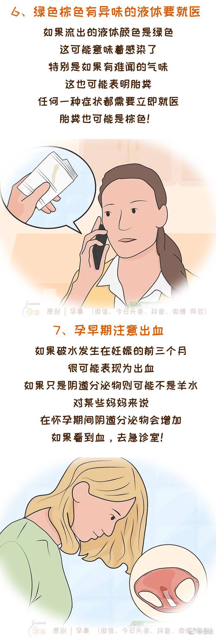 羊水破了的症状和注意事项 孕妈妈一定要了解