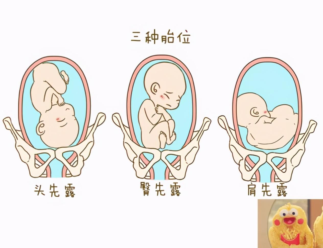 孕肚左边大右边小?“大小肚”与孕妈这一习惯有关,准妈妈别大意|准妈妈|子宫|胎位_新浪新闻