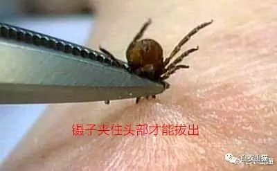 蜱虫为何会使人生病?被叮咬后该如何处理才安全?及时正确取出蜱虫!休闲区蓝鸢梦想 - Www.slyday.coM 蜱虫为何会使人生病?被叮咬后该如何处理才安全?及时正确取出蜱虫!休闲区蓝鸢梦想 - Www.slyday.coM