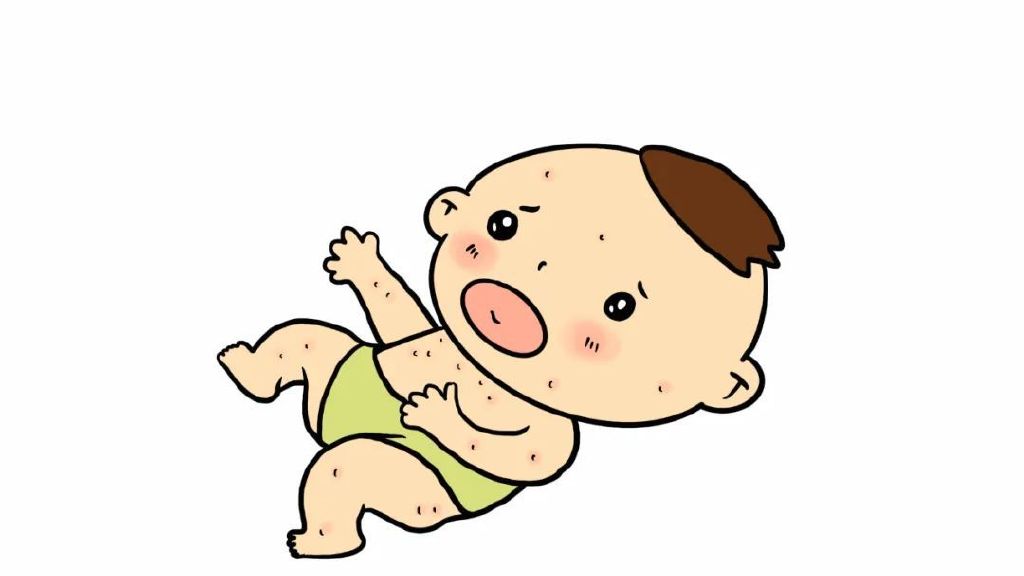 关于药疹,这3个基本常识建议尽早掌握|药疹|药物|症状_新浪新闻