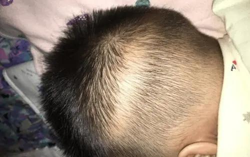 孩子这 4 种表现,不是缺钙!
