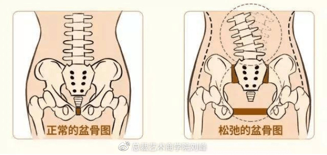 而产后的骨盆骨骼移位,加上不正确的行走,坐卧姿势,肌肉群的受力不均