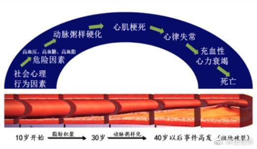 专家:通络药物可阻抑心血管事件链__财经头条