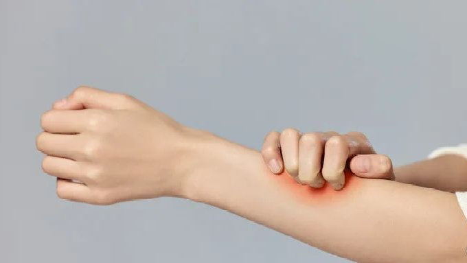 带状疱疹后期痒正常吗 带状疱疹基本好了又出小疹 带状疱疹二次复发前兆 阿昔洛韦乳膏怎么用