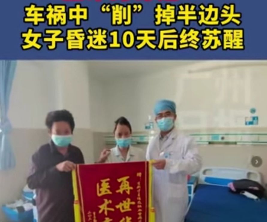 奇迹！女子车祸被削半边头，大难不死，二次手术后有望恢复正常休闲区蓝鸢梦想 - Www.slyday.coM