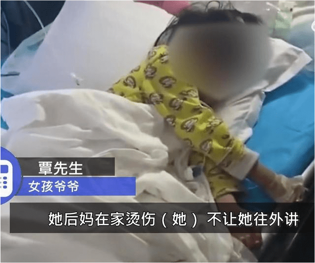 贵州4岁女孩被虐待 双脚烫伤严重需截肢 爷爷发声后妈很凶休闲区蓝鸢梦想 - Www.slyday.coM