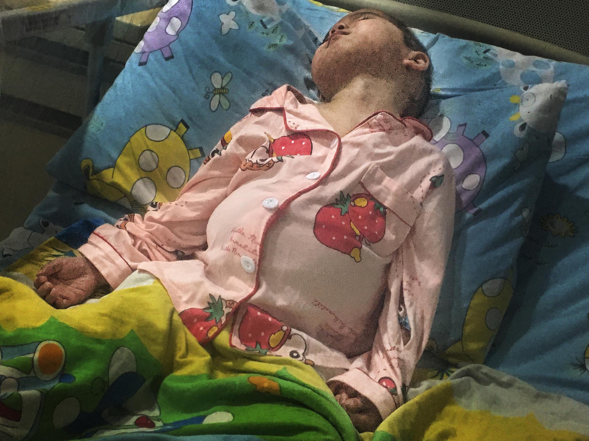 萌娃腹胀如球全身发红,哥哥与其视频大哭:这不是我妹妹