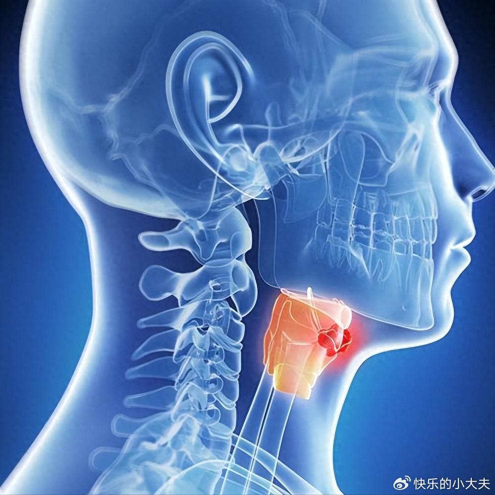 声音嘶哑别忍了,4类人群小心喉癌,早发现早治愈,生存率超90%|耳鼻咽喉科|癌细胞|癌症|感冒|声带_新浪新闻