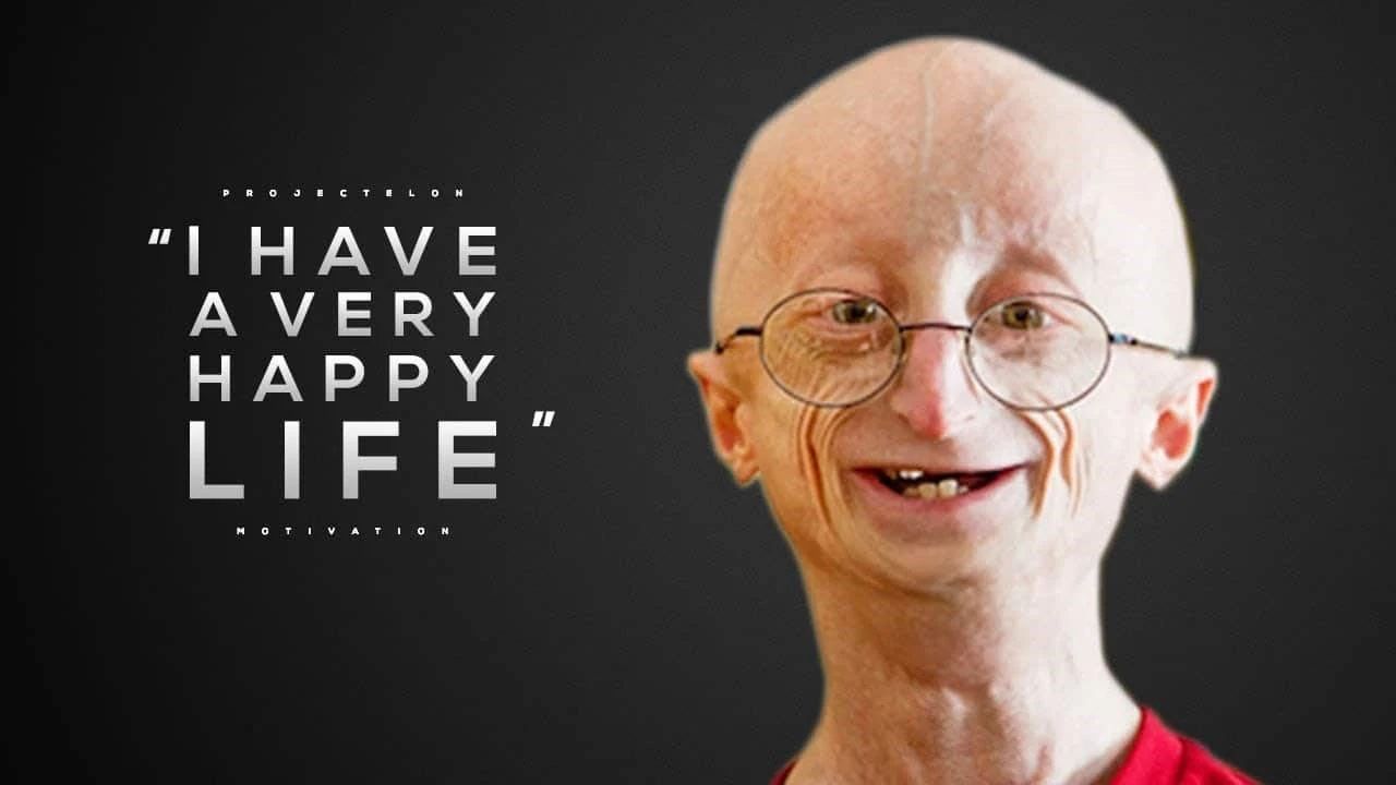 还没长大就已老去首个早老症疗法获批让他们身体里的沙漏慢一点