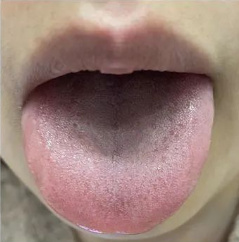 出现新冠轻症时,可以选连花清瘟 小柴胡颗粒一起