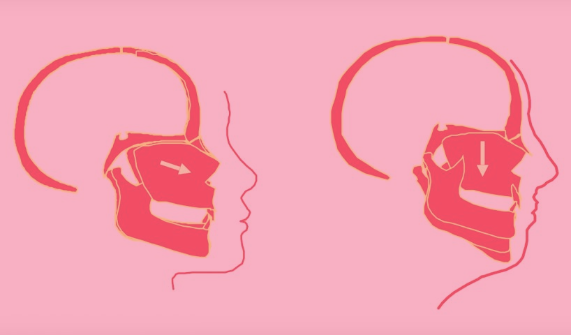 mew建议每天至少4小时的mewing,做的时候记得要抬头挺胸,融入生活