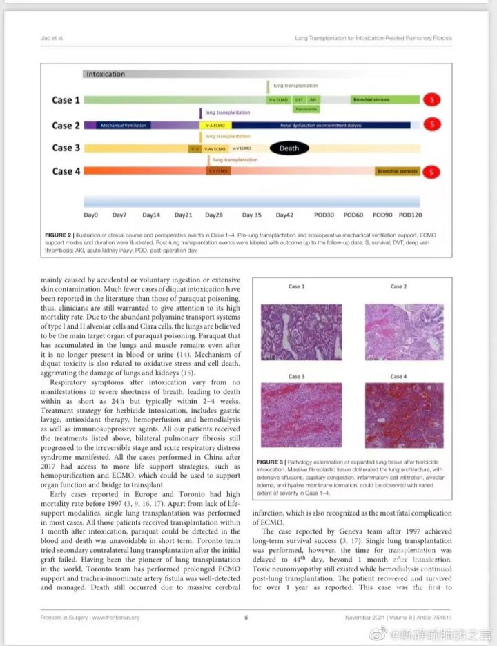 遭姐夫投毒百草枯的河北18岁女孩今天凌晨3点已顺利完成双肺移植手术！目前已苏醒，生命体征平稳休闲区蓝鸢梦想 - Www.slyday.coM