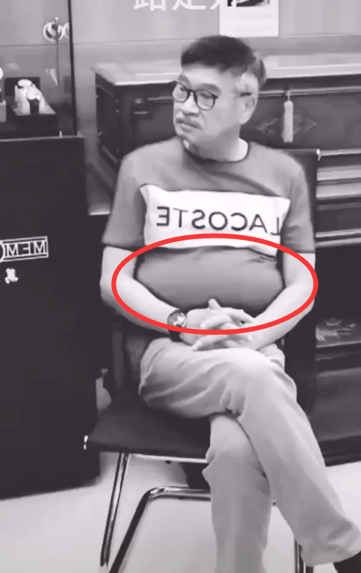 粉丝公开吴孟达肝癌晚期照片肝腹积水非常严重肚子大的像气球