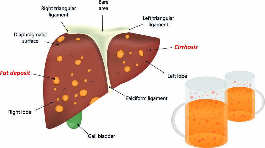 研究称用小杯能减少饮酒量?要想降低酒精的伤害,劝你做到这4点休闲区蓝鸢梦想 - Www.slyday.coM 研究称用小杯能减少饮酒量?要想降低酒精的伤害,劝你做到这4点休闲区蓝鸢梦想 - Www.slyday.coM