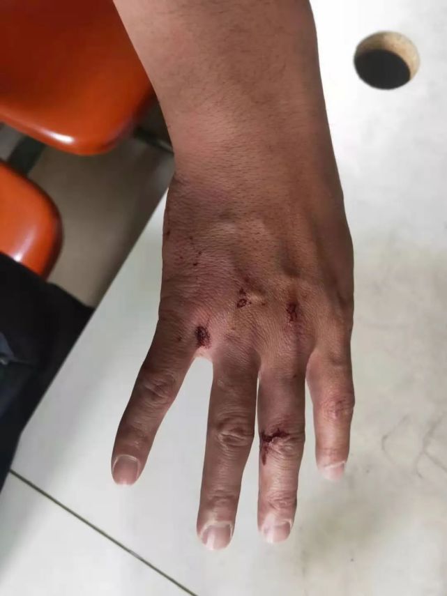 月度平安之星张亮亮他是拳头警察为救人两度赤手空拳砸车窗